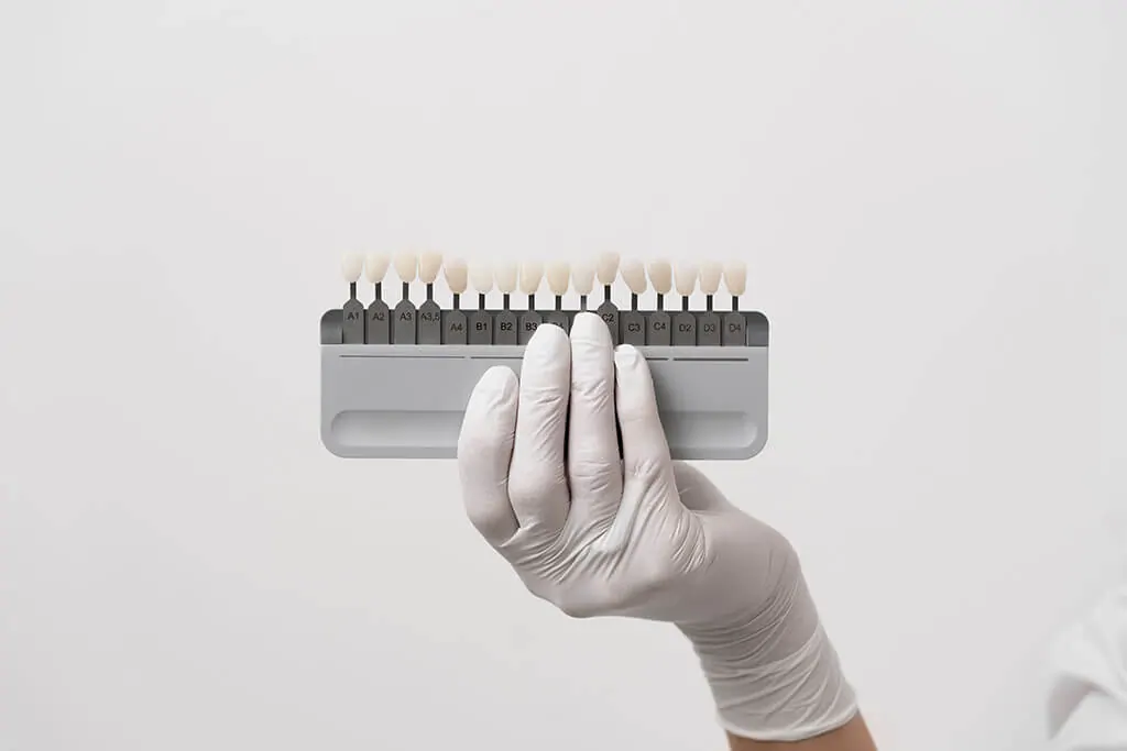 Dental crowns treatment at Des Plaines Dental Studio