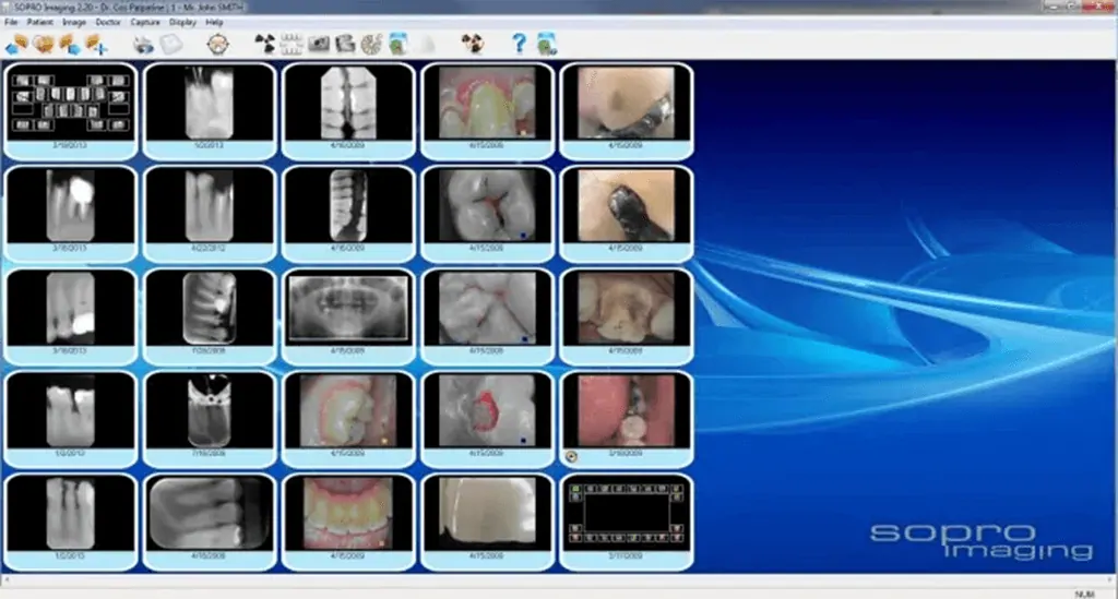 Digital x-rays at Des Plaines Dental Studio