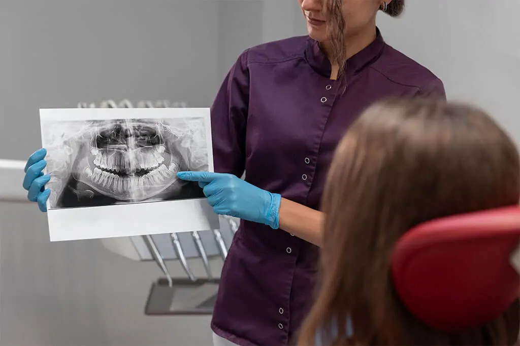 root canal therapy