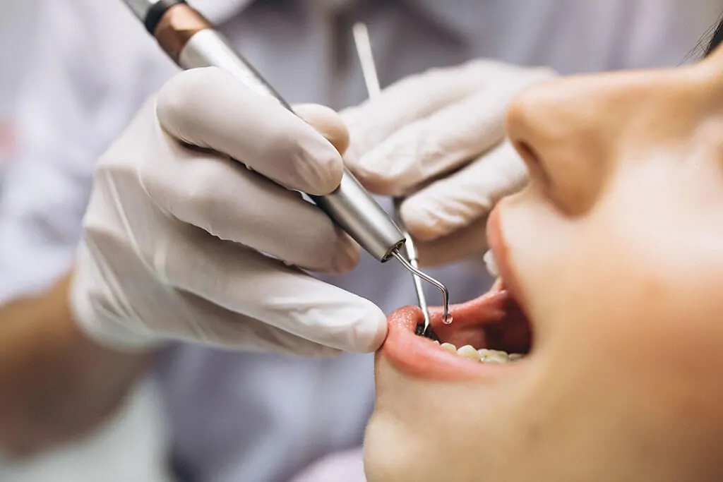 Patient before dental extractions at Des Plaines Dental Studio
