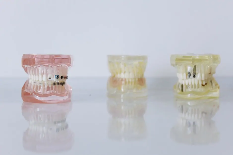 average cost of full dental implants