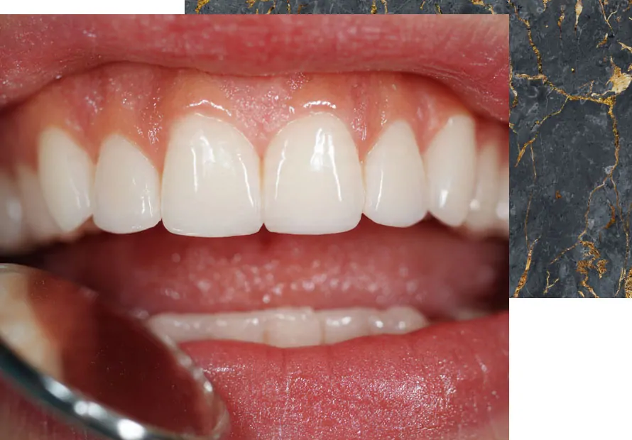 gum disease treatment in des plaines