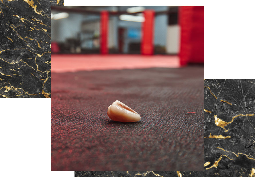 knocked out tooth des plaines