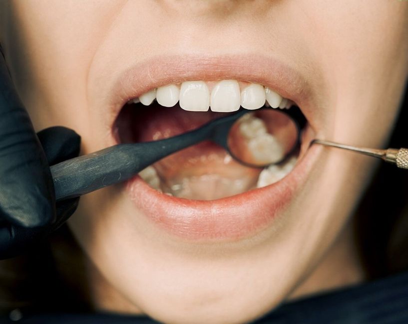 early gum disease patient reviews