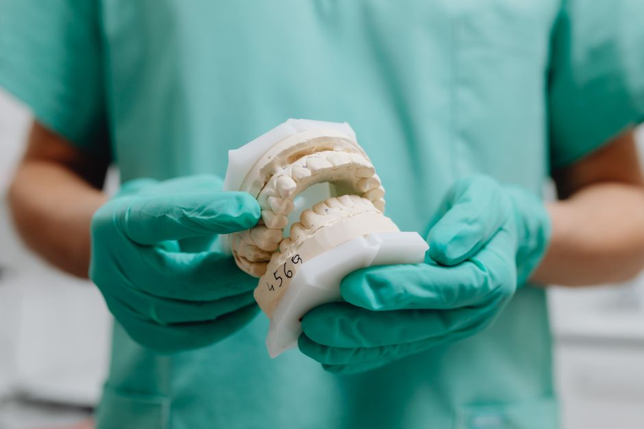 replacement molar cost