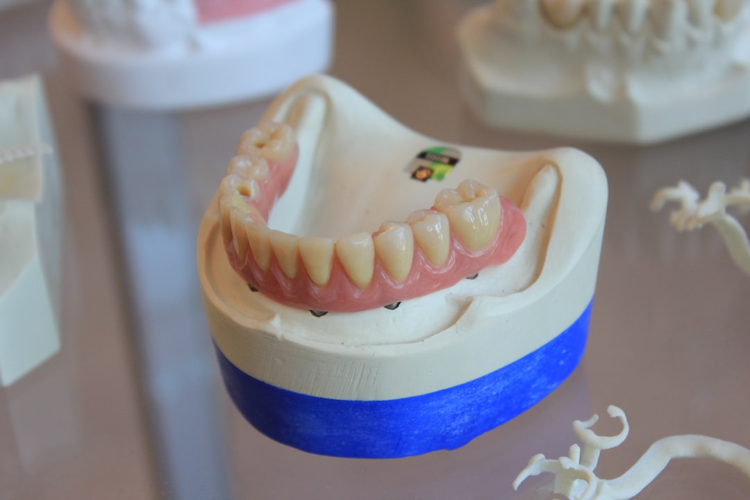 upper dentures consultation with dentist