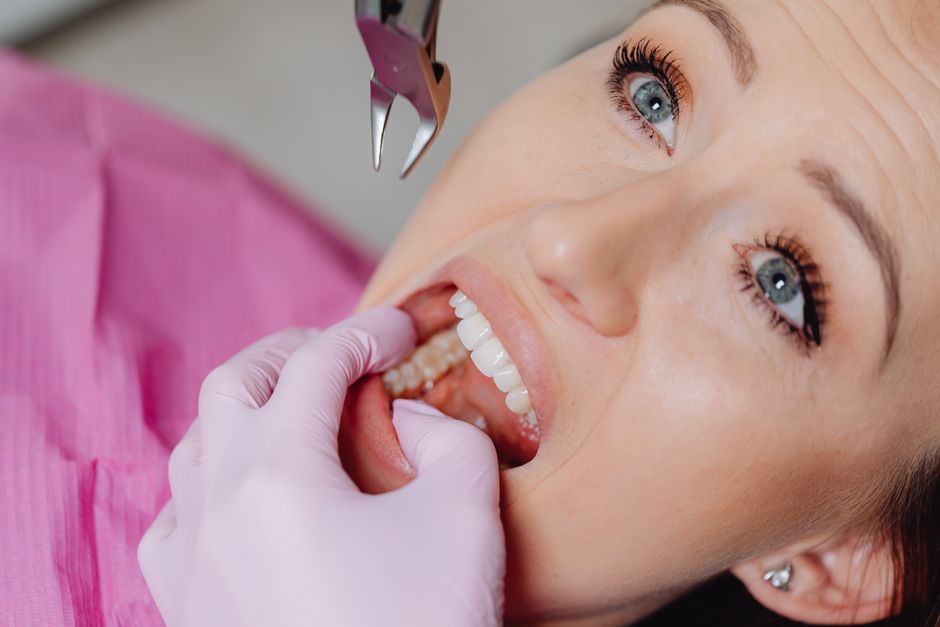 cost for dental extractions