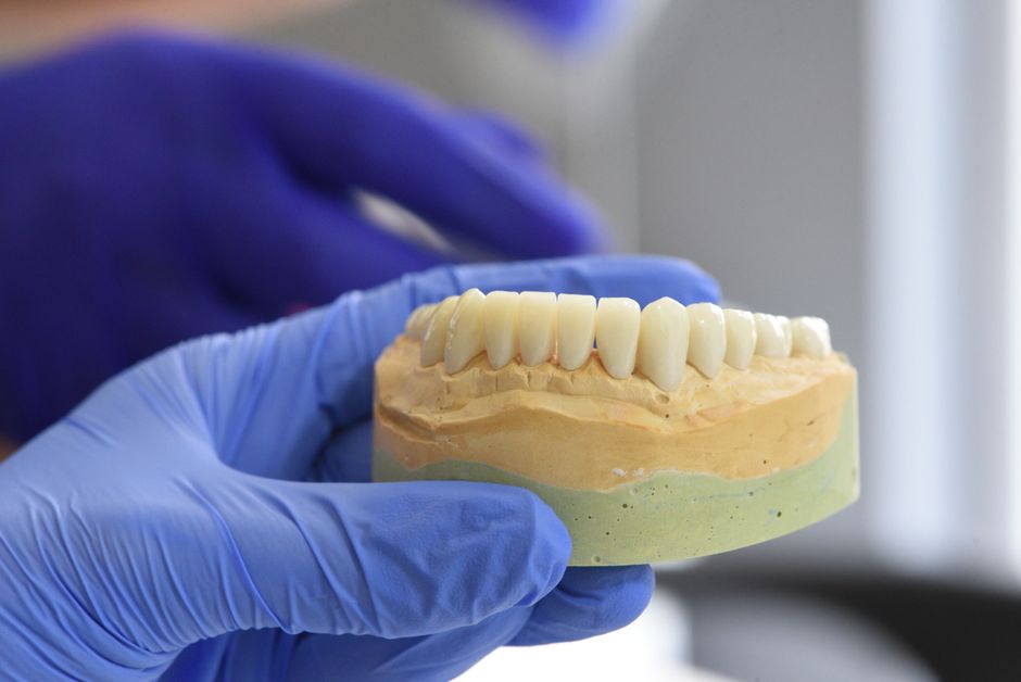 1 day dental implants near me