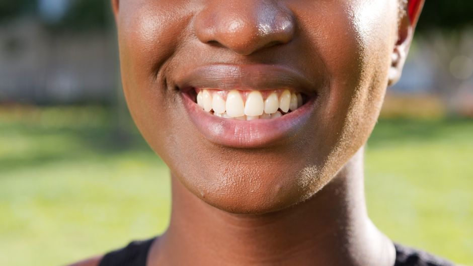 full mouth restoration patient smiling confidently