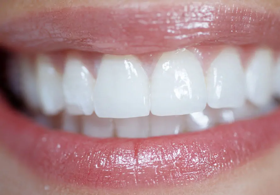 Dental implants in Des Plaines