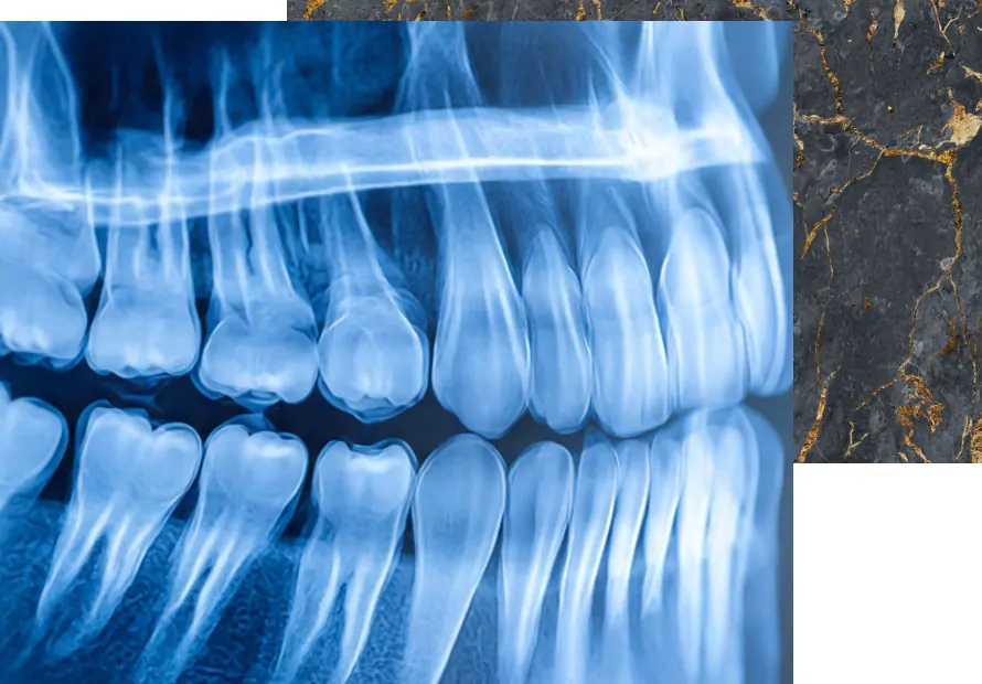Dental x-rays in Des Plaines