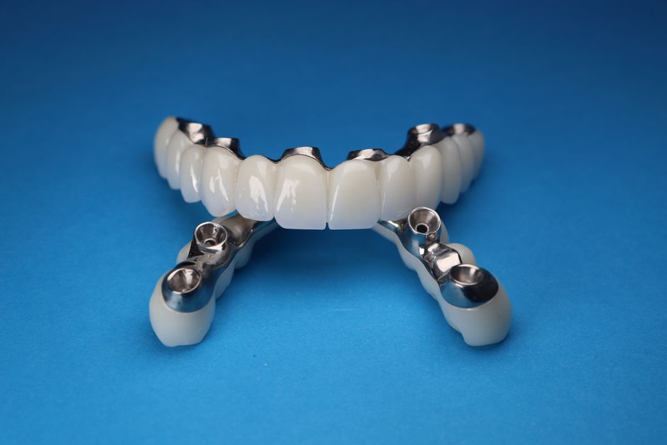 dental implant alternatives