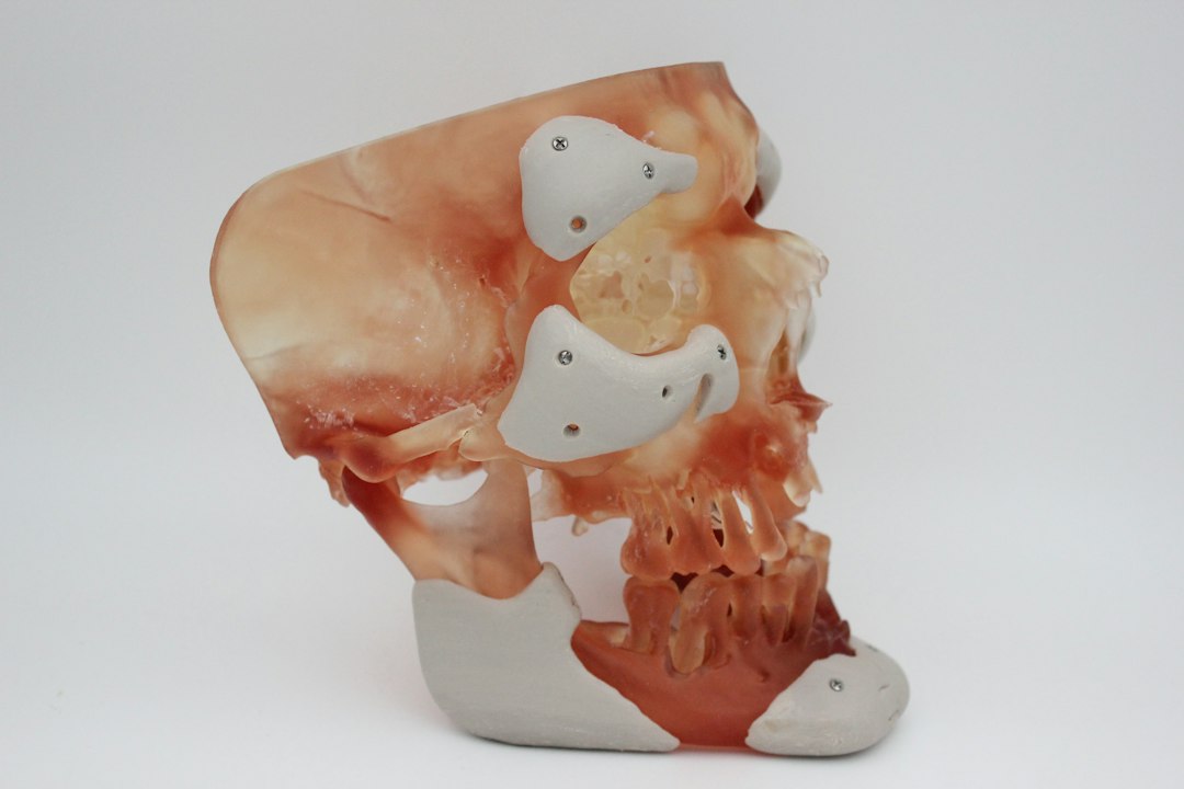 3D dental imaging of jawbone and extraction sites